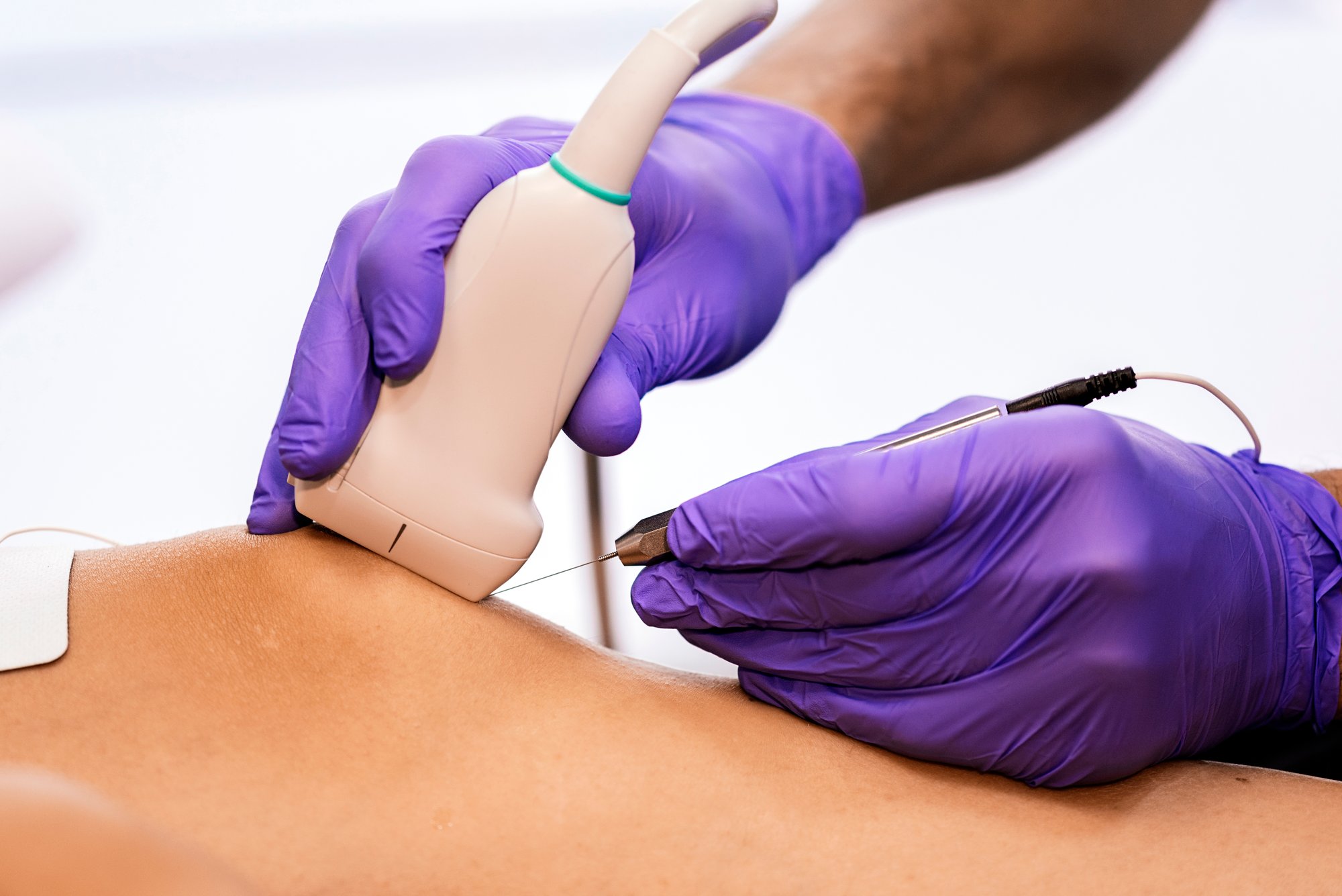 physiotherapist-giving-knee-therapy-to-a-woman-2024-10-18-07-50-08-utc